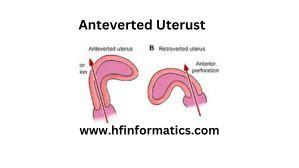 anteverted uterus with thin endometrium means|Anteverted Uterus: Definition, Fertility, Causes, Diagnosis, and More.